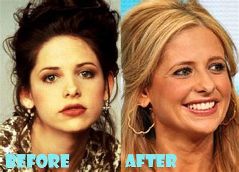 sarah michelle gellar nose job